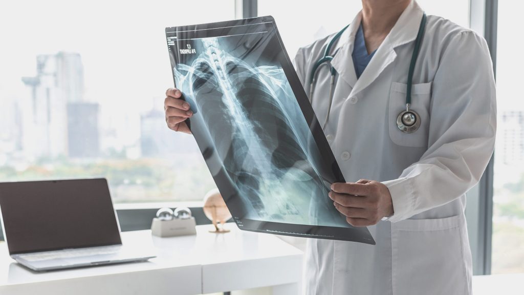 Eosinophilic Lung Diseases - preview image