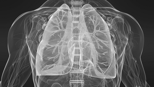 New guidelines for diagnosis of Idiopathic pulmonary fibrosis - article image