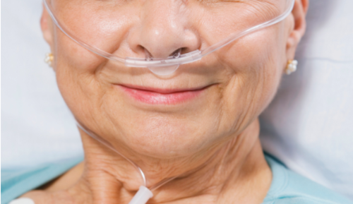 COPD patients suffer fewer respiratory-related problems when treated with Targeted Lung Denervation - preview image