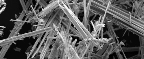 Exposure to occupational carcinogens affects the molecular pattern of lung cancers in never-smokers - article image
