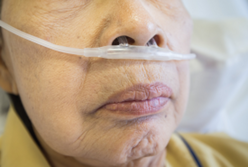 Researchers develop algorithm that is able to identify clinically relevant COPD phenotypes - article image