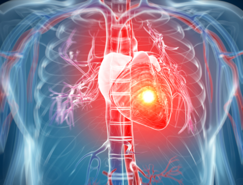 Adaptive servo ventilation use may increase cardiovascular risk in sleep apnoea patients - article image