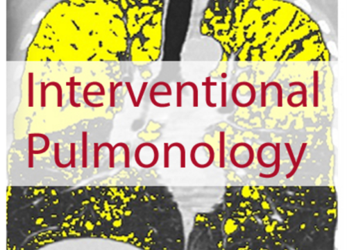 New CME Online module: Choosing the right interventional pulmonary technique for your patient - article image
