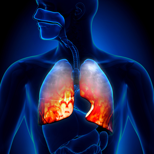 The Stop TB Partnership warns of insufficient funding to tackle tuberculosis - article image