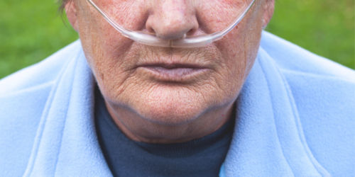 COPD death rates are falling in many countries but the total number of deaths is increasing - article image