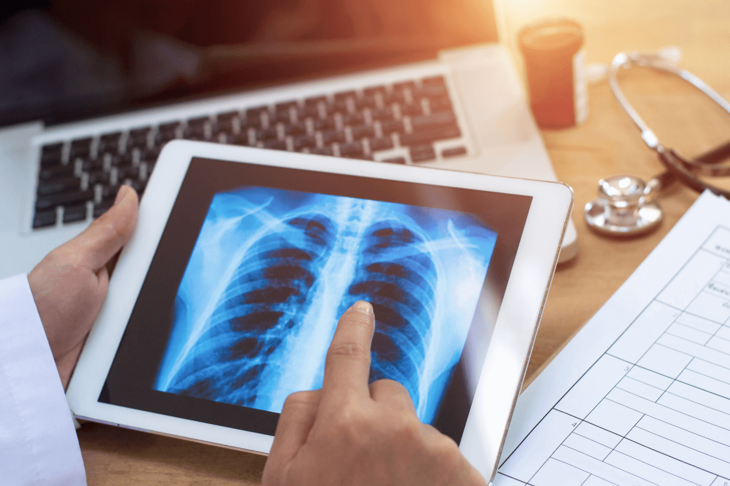 ERS statement on chronic thromboembolic pulmonary hypertension - preview image