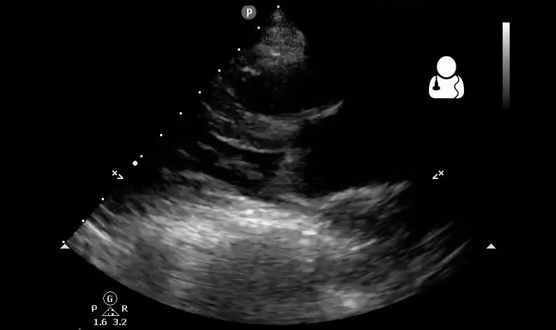 Thoracic ultrasound certified training programme – part one - Preview Image