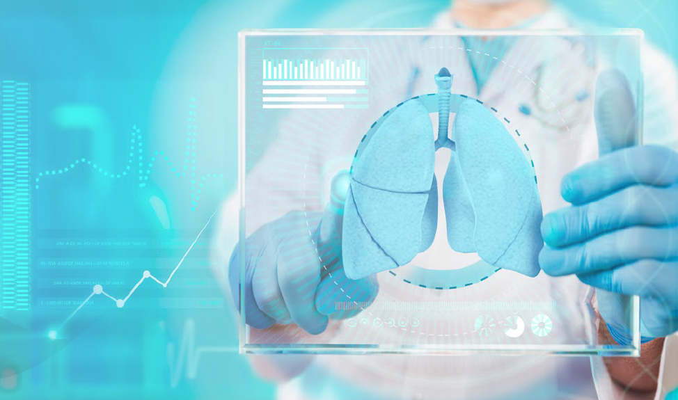 Accelerating EU research for rare diseases – the case of pulmonary hypertension - preview image