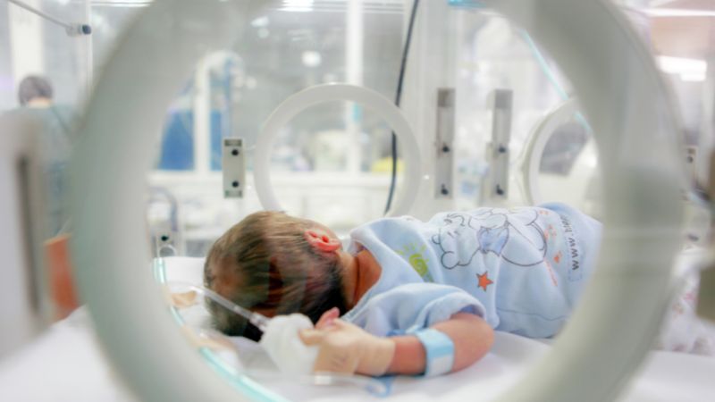 Artificial Intelligence can be trained to detect lung disease in premature babies - article image