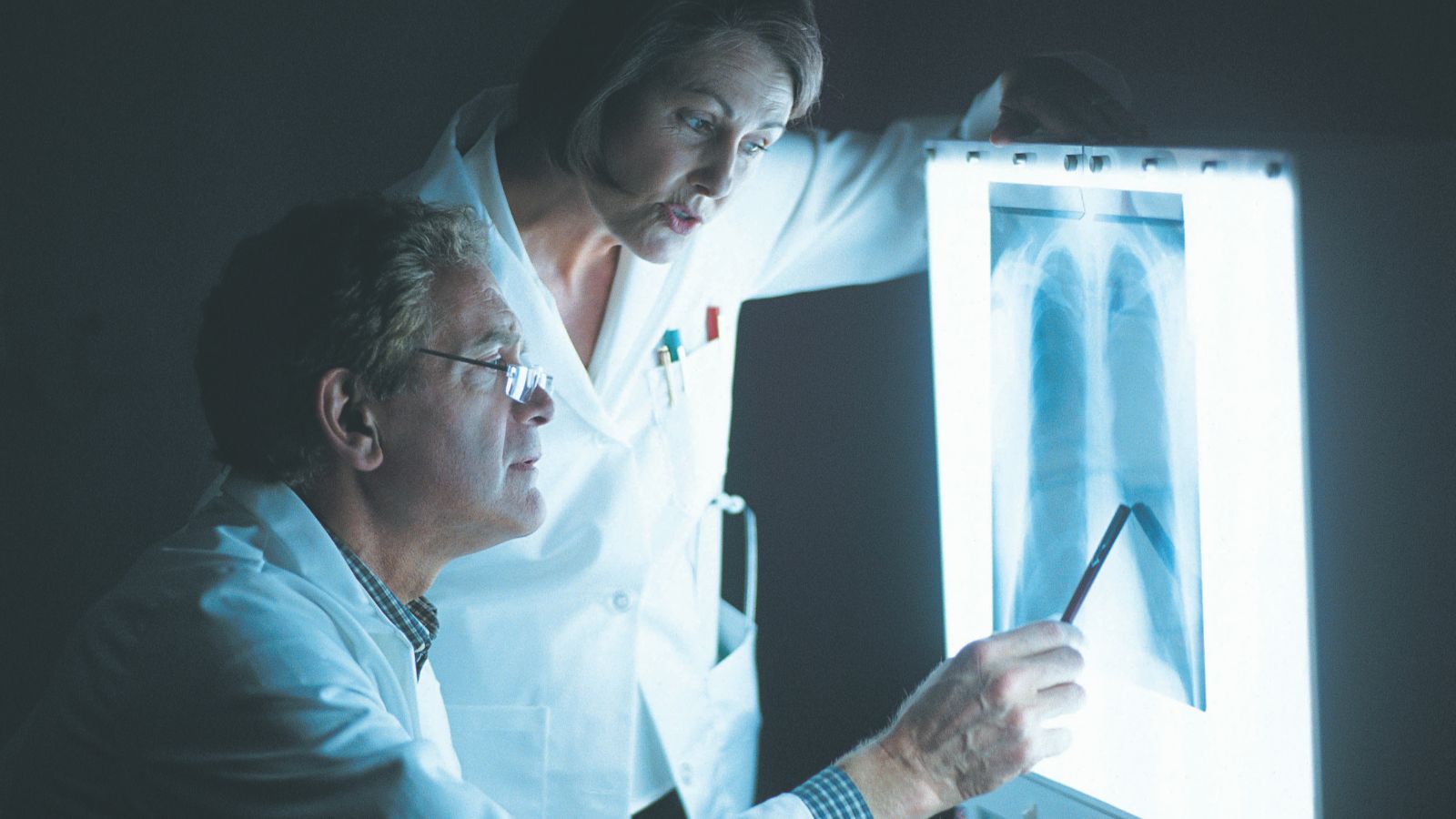 Lung cancer screening and early-stage lung cancer: multicentric platform-based real-world data and research - preview image