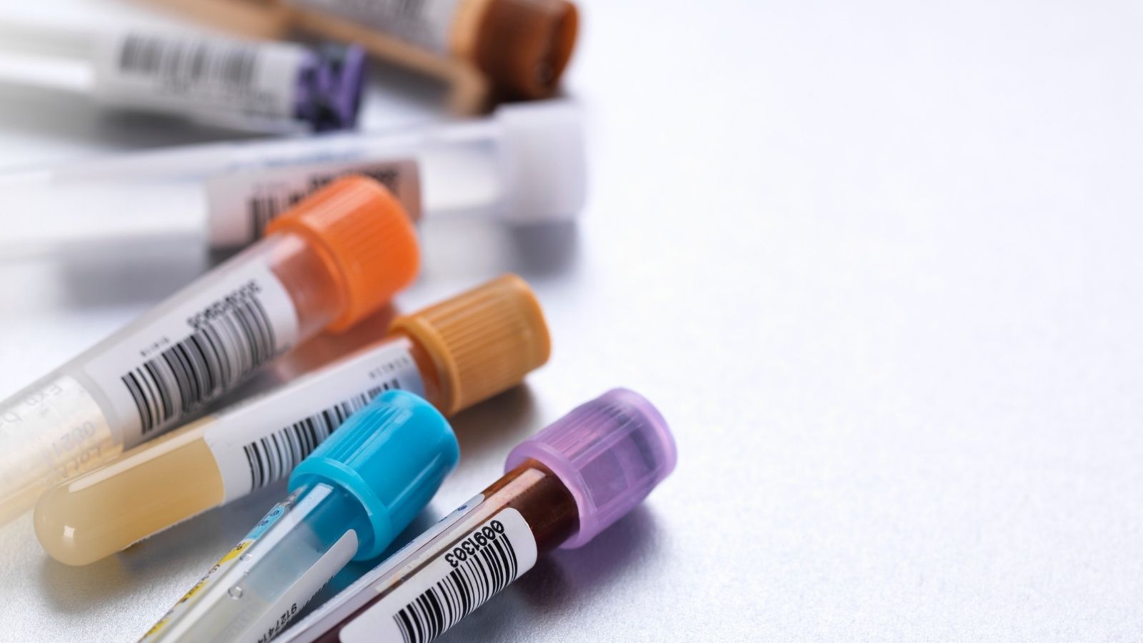 Journal club on European guidelines for the management of tuberculosis screening procedures in migrants: a systematic review - preview image