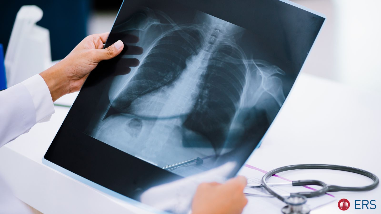 Panel discussion on paediatric large airway diseases: insights from radiology and pulmonology - preview image