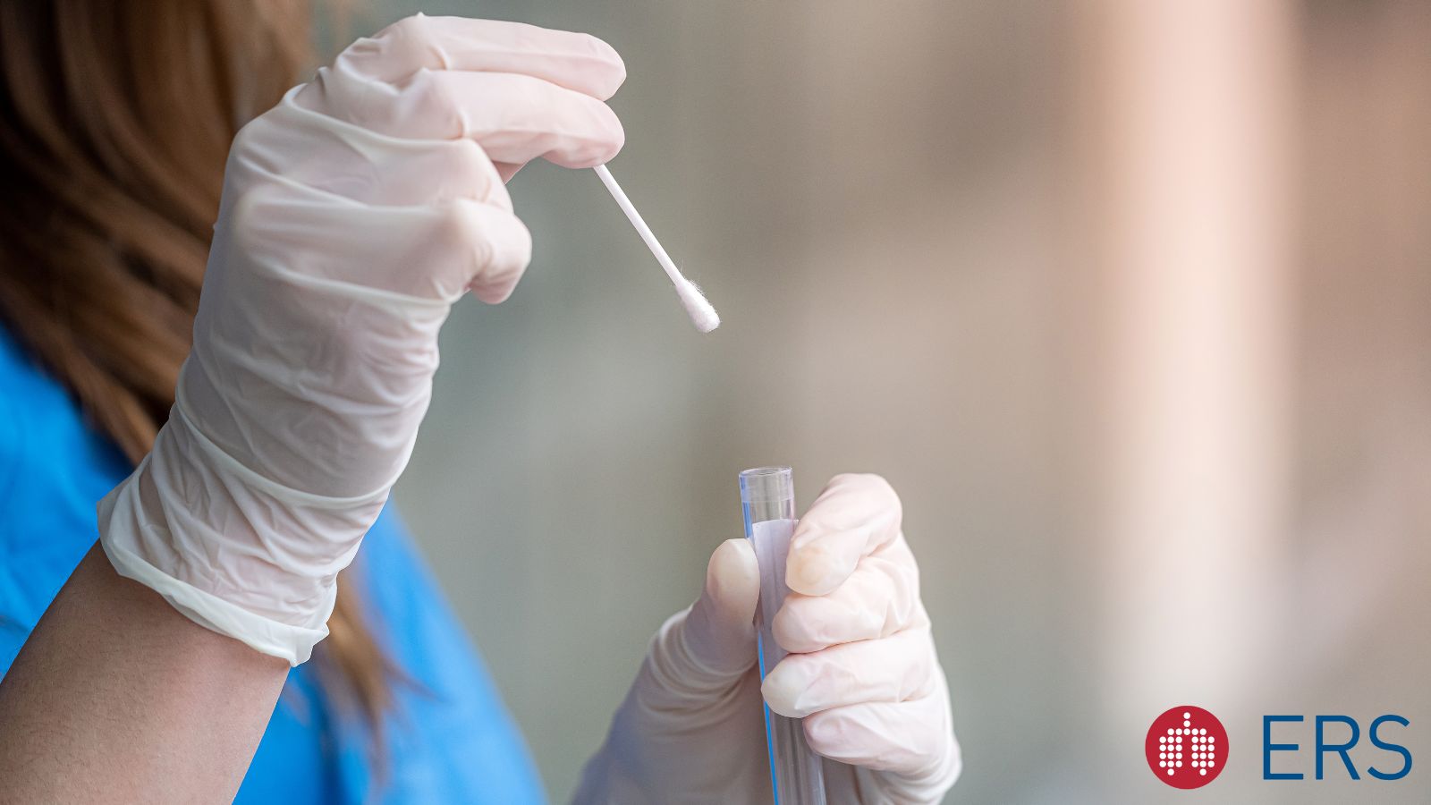 Panel discussion on recent advances in sputum-free diagnosis of tuberculosis - preview image