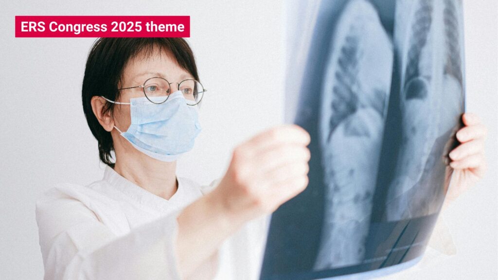 Panel discussion on global application of the lung cancer screening programme - preview image