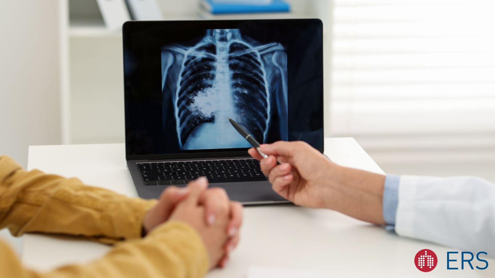Changes in the TB regimens for both isoniazid preventive therapy and treatment - preview image