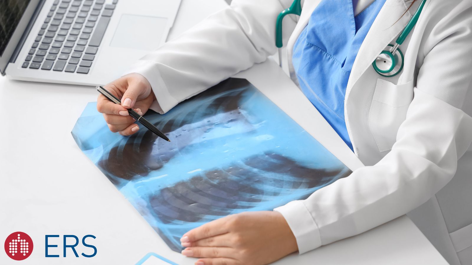 Interstitial lung disease – clinical year in review 2025 - preview image